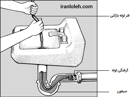 لوله بازکنی طرشت